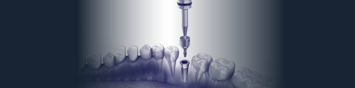 3-Dec-12-2022-08-19-09-8014-AM